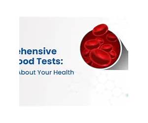 Guide To Blood Tests: In the context of a low-carb, ketogenic or carnivore way of eating Guide To Blood Tests: In the context of a low-carb, ketogenic or carnivore way of eating