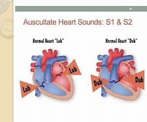 Heartsound Heartsound