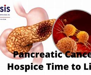 Living with Pancreatic Cancer: A Patient and Family Guide Living with Pancreatic Cancer: A Patient and Family Guide