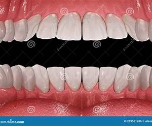 Teeth: An Oral History Teeth: An Oral History